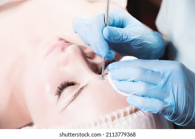 Close-up Of The Face Of A Young Caucasian Woman And The Hands Of A Cosmetologist In Gloves Perform Mechanical Cleaning And Removal Of Blackheads On The Skin Of A Client