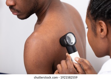 Close-up Of A Female Doctor Checking Pigment Skin On Man's Back With Dermatoscope
