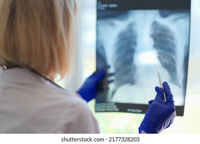 Close-up Of Female Doctor Pulmonologist Holding X-ray Photograph Of Lungs In Hands. Radiologist Making Diagnostic Of Patient. Medicine And Checkup Concept