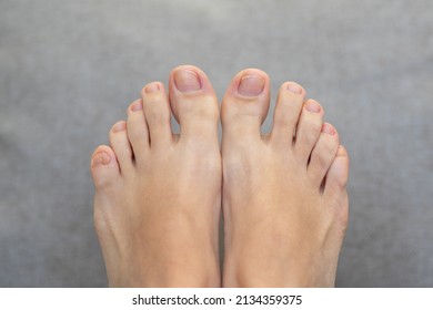 Closeup of female feet and toes on white background. Healthy feet concept