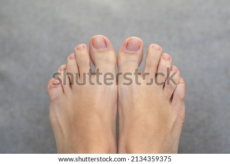 Closeup of female feet and toes on white background. Healthy feet concept