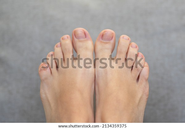 Closeup of female feet and toes on white\
background. Healthy feet\
concept