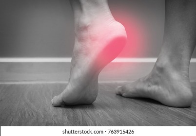Closeup of a female foot heel pain with red spot, plantar fasciitis