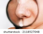 Close-up of a female nose with blackheads or black dots in a magnifying glass on a white background. Acne problem, comedones. Enlarged pores on the face. Cosmetology dermatology concept