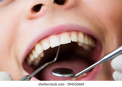 Close-up Of Female With Open Mouth During Oral Checkup At The Dentist.Dentist