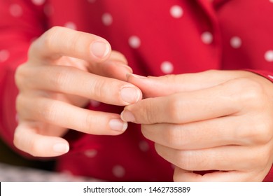 Closeup: Female's fingernails which is thin weak and cracked, it's damaged from chemical in manicure products and lack of Vitamins, Iron, Calcium. Beauty Fingernails problem and treatment concept.