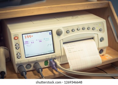 Close-up Fetal Monitor Or Non Stress Test Printing Baby Heart Beats, Electrocardiograph And Mother Uterine Contraction. Labor And Delivery Room At Hospital