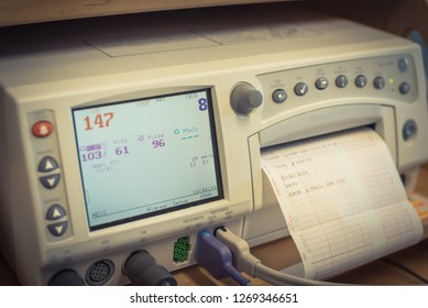 Close-up Fetal Monitor Or Non Stress Test Printing Baby Heart Beats, Electrocardiograph And Mother Uterine Contraction. Labor And Delivery Room At Hospital