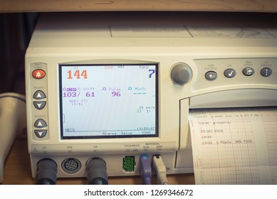 Close-up Fetal Monitor Or Non Stress Test Printing Baby Heart Beats, Electrocardiograph And Mother Uterine Contraction. Labor And Delivery Room At Hospital