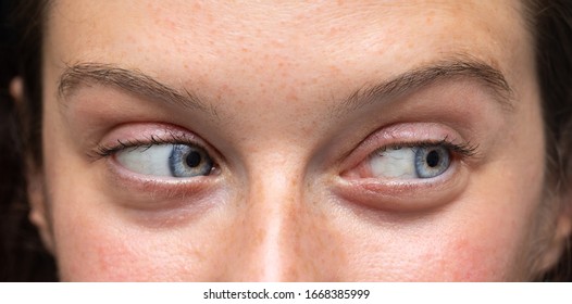 Closeup Of Funny Facial Expression With Sideways Glance And Raised Brows