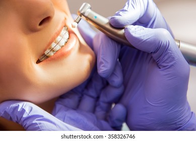 Close-up. Girl with braces on the teeth, at a reception at the dentist