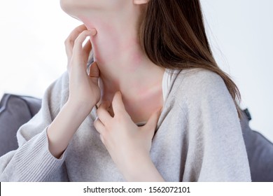 Closeup  Girl Is Scratching Her Neck With Nails. Reddened, Inflamed Body Parts Causes Discomfort And Itching. Young Woman Is Suffering From Bouts Of Allergies. Dermatological Skin Diseases Concept.