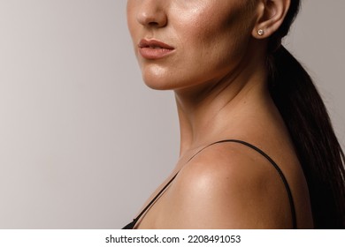 Close-up Girl With Sweaty Skin On Her Face And Excessive Oily Sheen, Excessive Sweating, Hyperhidrosis Disease