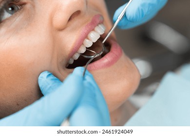 Close-up of a girl's smile, oral diagnostics by a dentist close-up. The dentist works closely on the treatment of the patient's teeth, using a microscope for maximum accuracy and detail. This process - Powered by Shutterstock