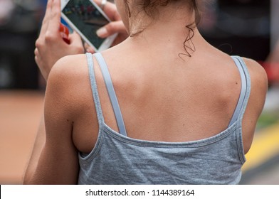 Closeup Of Goose Bump On Woman Skin Back In Outdoor 