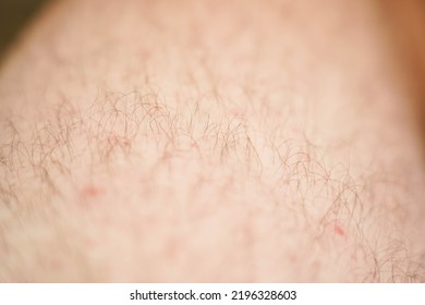 Close-up Of Hairy Skin. Hair On Human Skin.