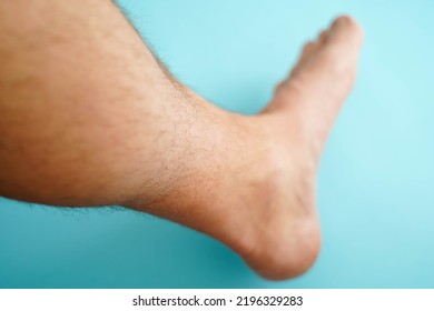 Close-up Of Hairy Skin. Hair On A Man's Leg