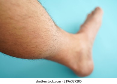 Close-up Of Hairy Skin. Hair On A Man's Leg