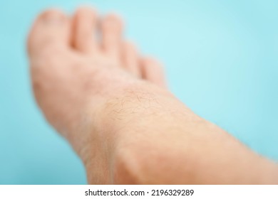 Close-up Of Hairy Skin. Hair On A Man's Leg