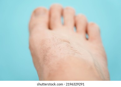 Close-up Of Hairy Skin. Hair On A Man's Leg