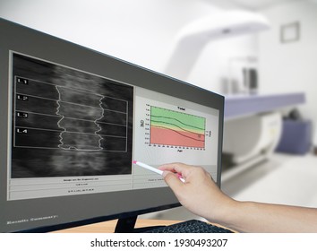 Close-up Hand Doctor Point Image Of DXA Bone Density Scan On A Monitor In A Woman Of 50 Years To Prevent Osteoporosis. Blurry Bone Densitometer Machine Background.          