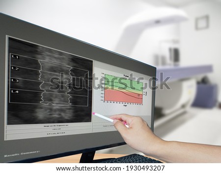 Close-up hand Doctor point Image of DXA bone density scan on a monitor in a woman of 50 years to prevent osteoporosis. blurry bone densitometer machine background.          