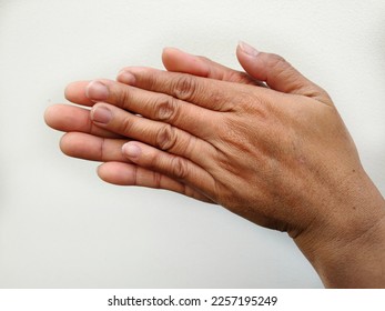 Close-up of the hand of a person who has worked hard or exercised hard, dark skin, hard, rough, dry skin, injury, sore wrist, wounded finger, locked finger and care concept  to recover and be healthy - Powered by Shutterstock