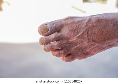 Closeup hand with skin old. the skin of an old man's feet