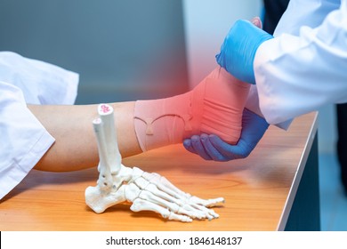 Close-up Hand Wear Medical Gloves Doctor In Medical Gloves Holds Artificial Boneof The Foot And Examines A Sore Ankle In Clinic, Concept Of Medical Orthopedic Treatment