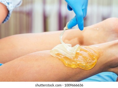 Close-up hands of cosmetologist in blue gloves applying paste for sugaring depilation on female leg , hair removal beauty procedure.