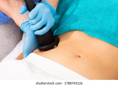 Closeup Of Hardware Procedure Of Rf Skin Lifting On Female Belly In Aesthetic Cosmetology Clinic