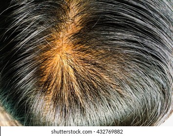 Woman With Thin Hair Images Stock Photos Vectors Shutterstock