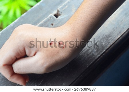 Close-Up of Human Hand with Snake Bite Marks – Medical Emergency Concept