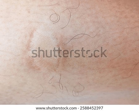 A Close-Up Of Human Skin With A Square Patch Of Discolored, Dry, And Slightly Peeling Skin. The Area Is Surrounded By Fine, Curled Hair Strands, And The Background Consists Of Natural Skin Texture