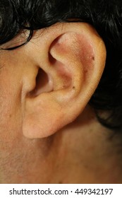 Closeup Human's Ear