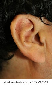 Closeup Human's Ear