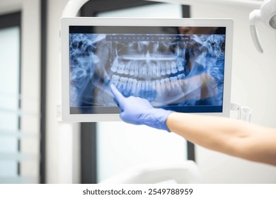 A close-up image capturing a dentist's gloved hand pointing to a dental X-ray on a screen, focusing on details and emphasizing the importance of examination.