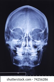 Closeup Image Of Classic Xray Image Of Skull