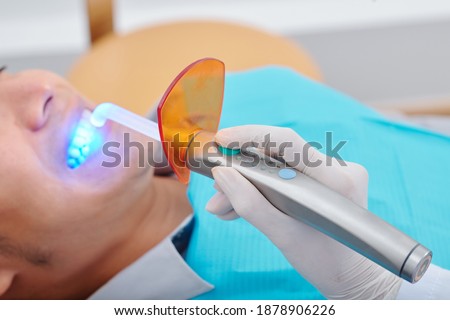 Close-up image of dentist using curing light is a piece of dental equipment that is used for polymerization of light cure resin based composites