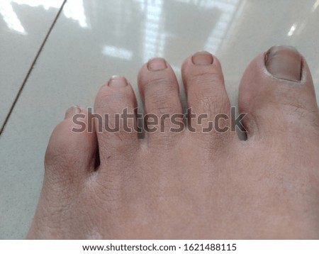 Close-up image of a human foot. Dirty uncleaned