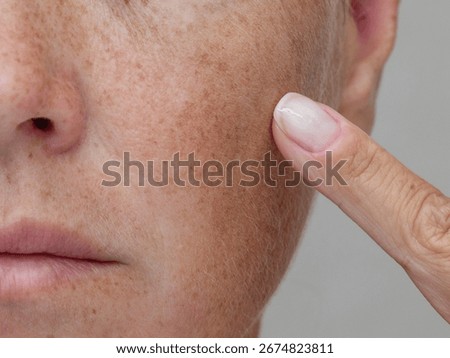 A close-up image showing a partial view of a woman's face, from below the eye to the chin, with her finger pointing at her freckles
