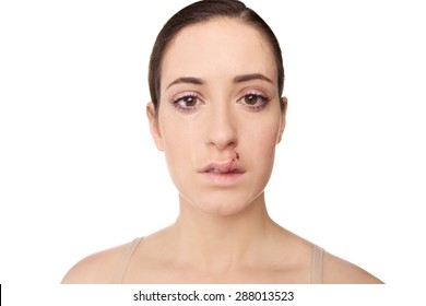 Closeup of injured woman's face with tears and a busted lip. 