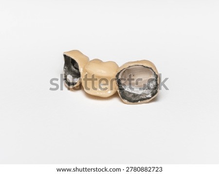 Close-up of the interior side of a 3-unit PFM dental bridge, showing the metal framework and porcelain exterior isolated on a white background