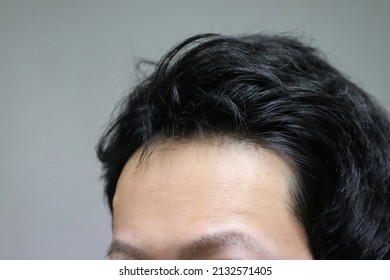 Close-up Of Japanese Men With Thin Hair