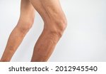 Close-up of knee injury medical pain muscle ache and pain Osteoarthritis Rheumatoid arthritis medical concept of elderly people having pain on a white background.