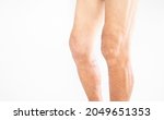 Close-up of knee injury medical pain muscle ache and pain Osteoarthritis Rheumatoid arthritis medical concept of elderly people having pain on a white background.