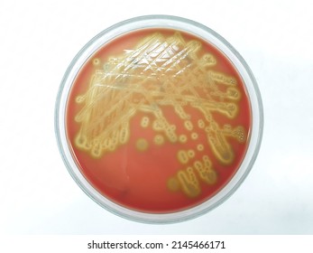 Close-up of Leuconostoc spp.  bacterial colonies growth on blood agar plate with white background from top view