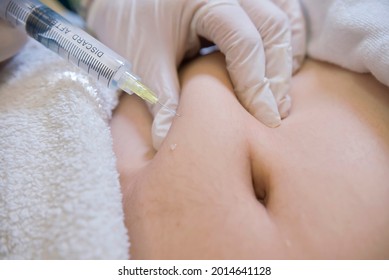 Closeup of a Lipotropic injection into the subcutaneous fat below the navel. Local Fat and Cellulite reduction procedure. Female aesthetic cosmetology in a beauty salon