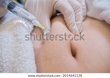 Closeup of a Lipotropic injection into the subcutaneous fat below the navel. Local Fat and Cellulite reduction procedure. Female aesthetic cosmetology in a beauty salon