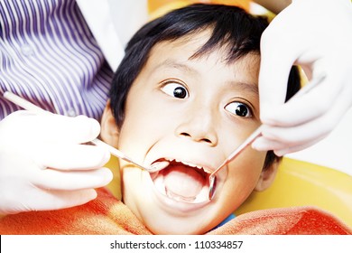 Close-up Of Little Boy Opening His Mouth Wide During Inspection Of Oral Cavity By Dentist